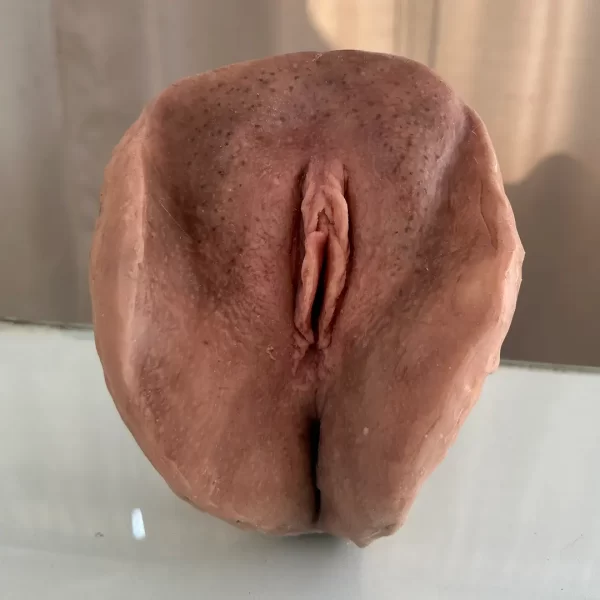 Vulva Pele