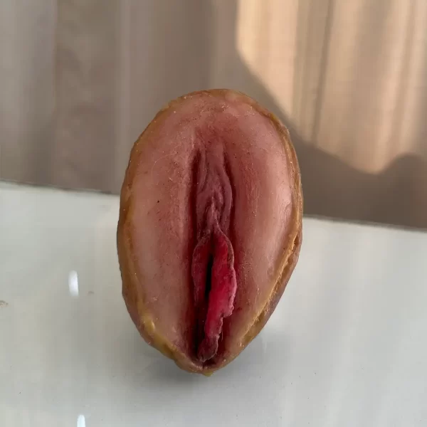 Vulva Outras Diferenças Anatômicas