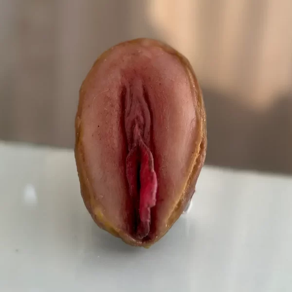 Vulva Outras Diferenças Anatômicas - Image 2