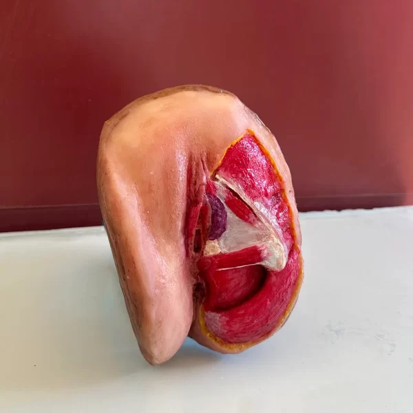 Vulva MP (metade músculos metade pele)