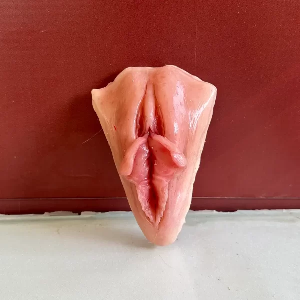 Vulva Outras Diferenças Anatômicas 2